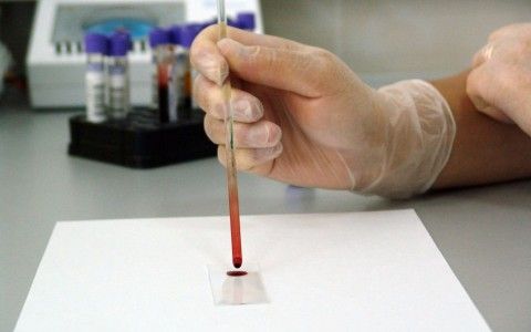 modificaciones geneticas y fisiomuro04