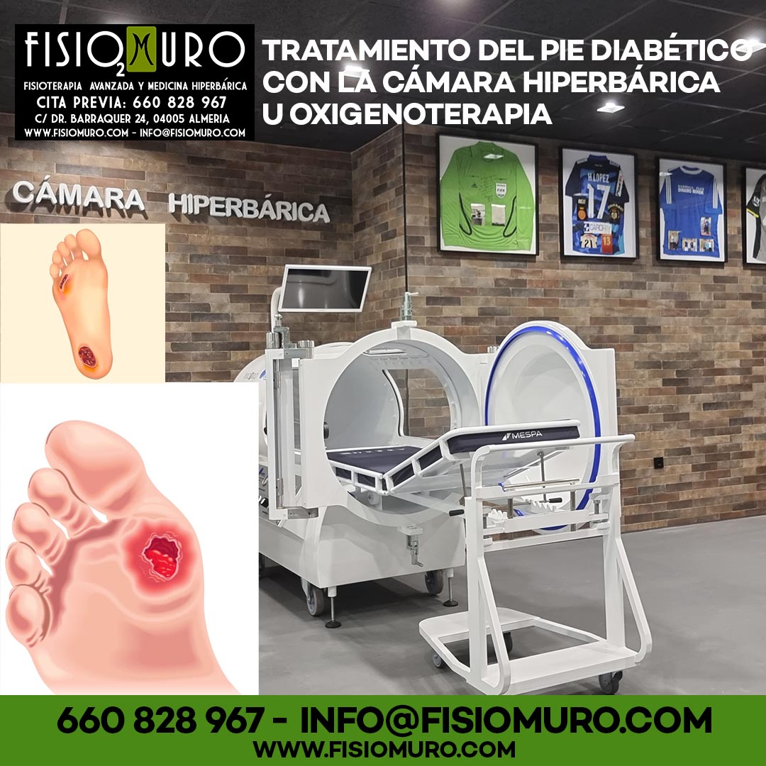 FISIOMURO CLINICA DE FISIOTERAPIA AVANZADA Y CÁMARA HIPERBÁRICA- Tratamiento del pie diabético con la Cámara Hiperbárica u Oxigenoterapia