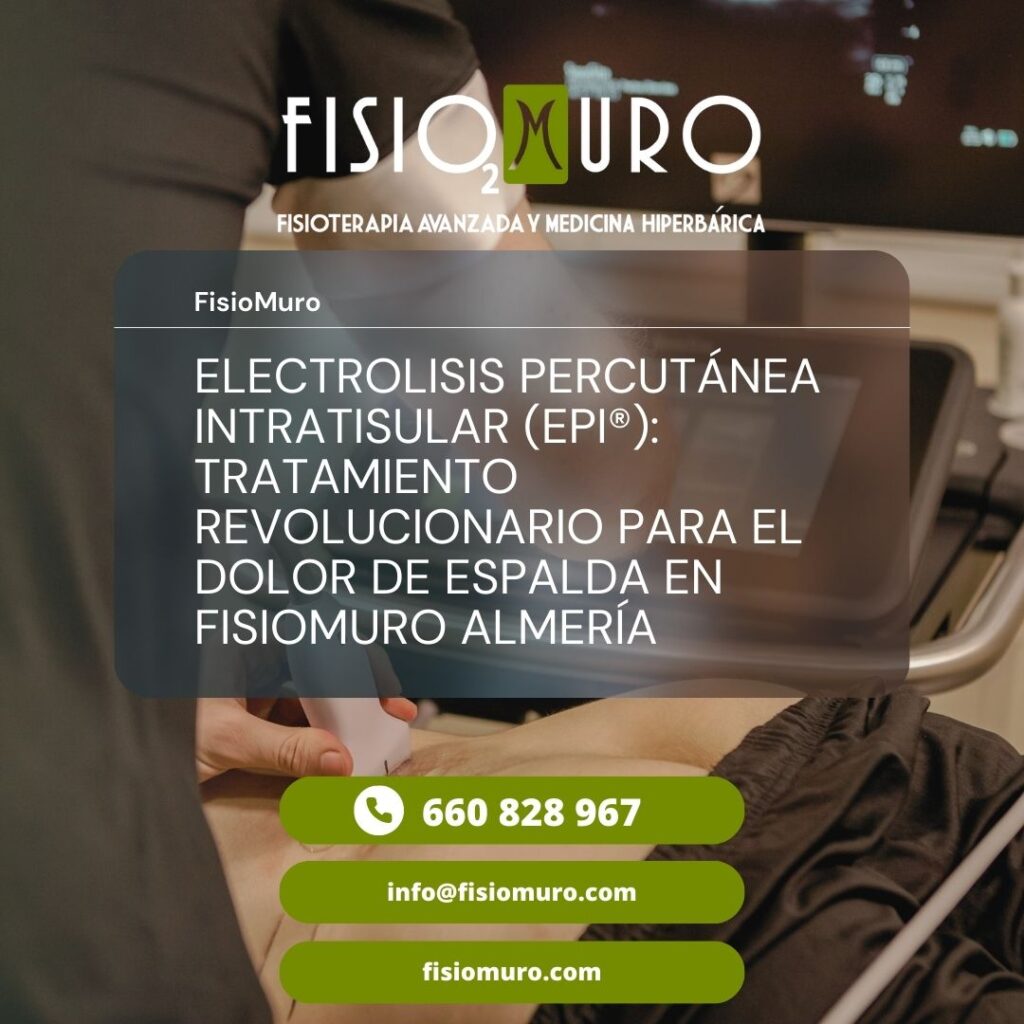 EPI TRATAMIENTO REVOLUCIONARIO PARA EL DOLOR DE ESPALDA EN FISIOMURO ALMERÍA