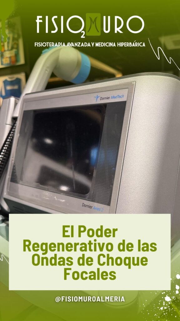 DORNIER ARIES 2 EN FISIOMURO ALMERÍA_ LA REVOLUCIÓN EN TERAPIA DE ONDAS DE CHOQUE FOCALES PARA TU RECUPERACIÓN MUSCULOESQUELÉTICA