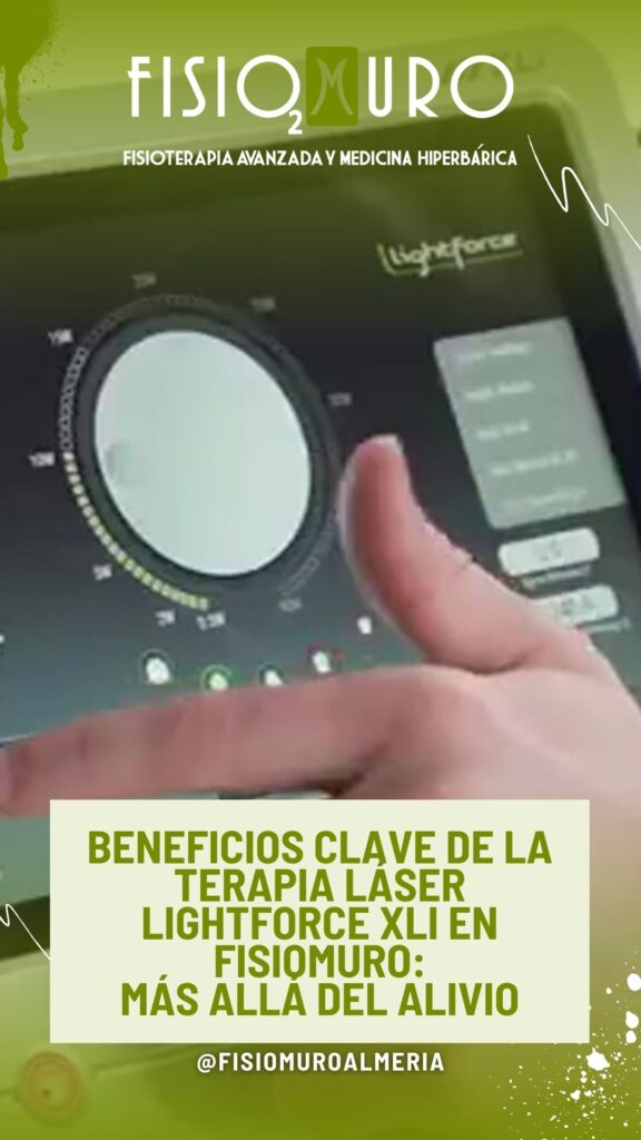 LIGHTFORCE XLI 40W EN ALMERÍA_ LA REVOLUCIÓN LÁSER EN FISIOTERAPIA AVANZADA DE CLÍNICA FISIOMURO