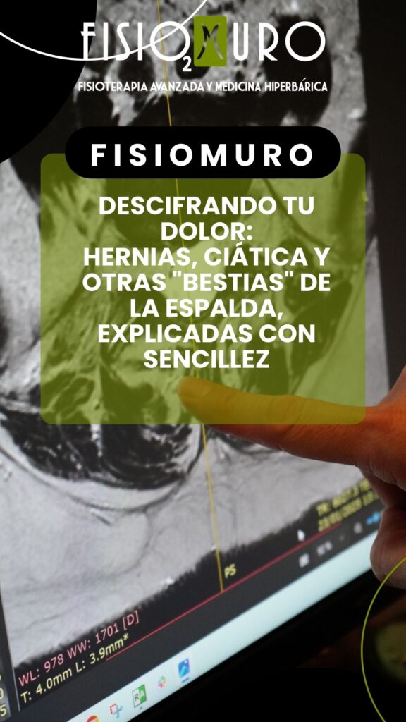 ELECTRÓLISIS PERCUTÁNEA RAQUÍDEA EN ALMERÍA_ LA REVOLUCIÓN CONTRA EL DOLOR DE ESPALDA Y CIÁTICA QUE TE ESPERA EN FISIOMURO
