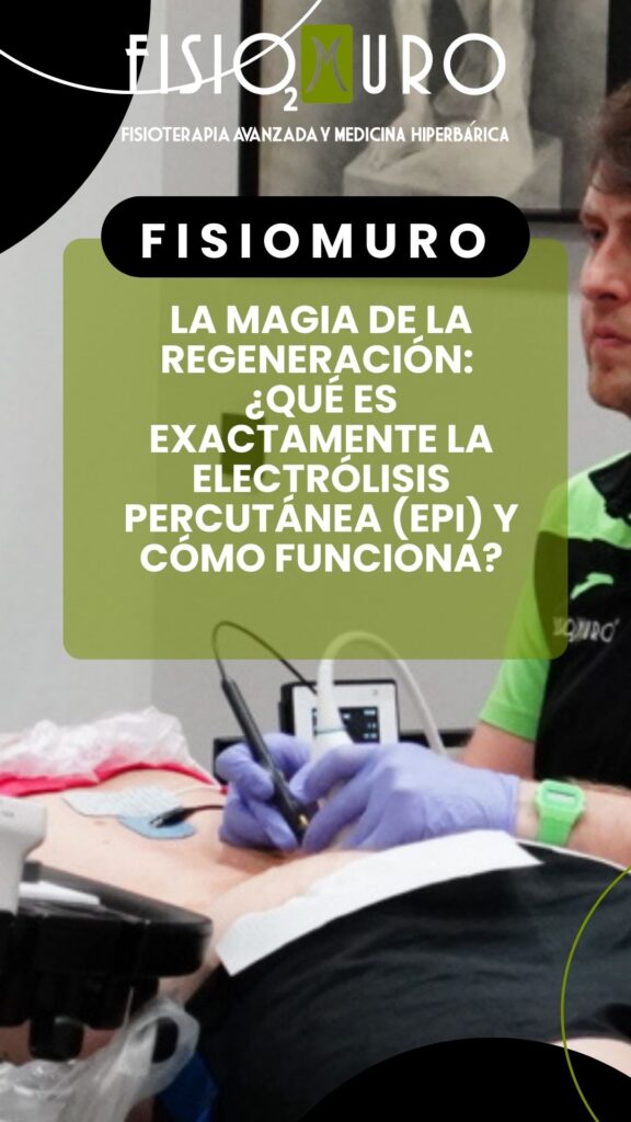 ELECTRÓLISIS PERCUTÁNEA RAQUÍDEA EN ALMERÍA_ LA REVOLUCIÓN CONTRA EL DOLOR DE ESPALDA Y CIÁTICA QUE TE ESPERA EN FISIOMURO