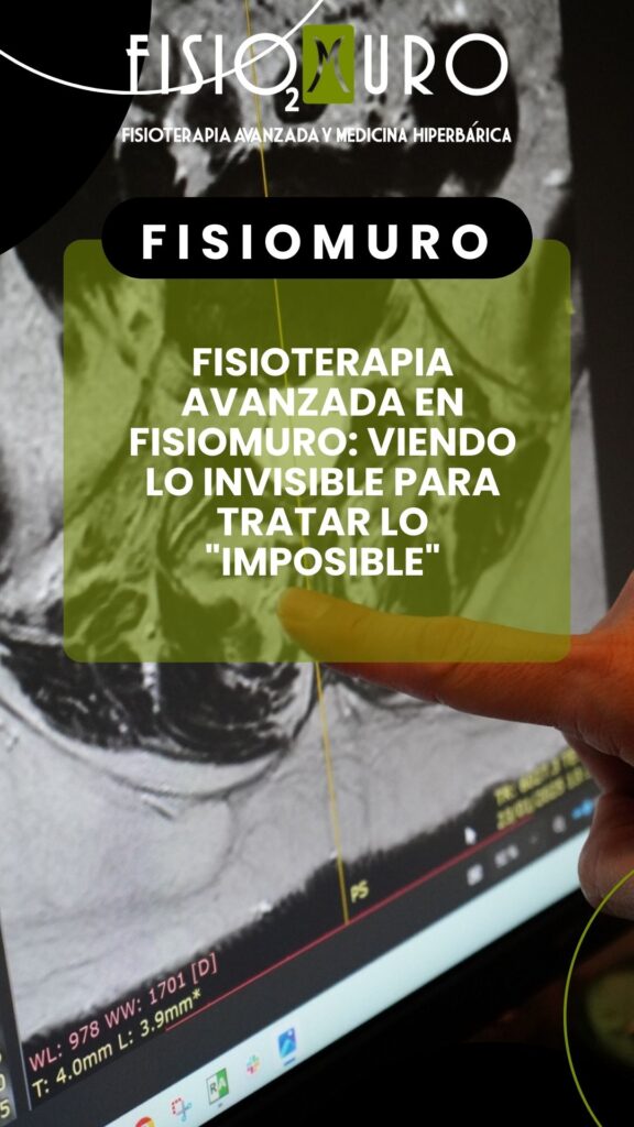 TU GUÍA COMPLETA DE FISIOTERAPIA AVANZADA EN ALMERÍA_ CÓMO DECIRLE ADIÓS AL DOLOR PARA SIEMPRE CON FISIOMURO